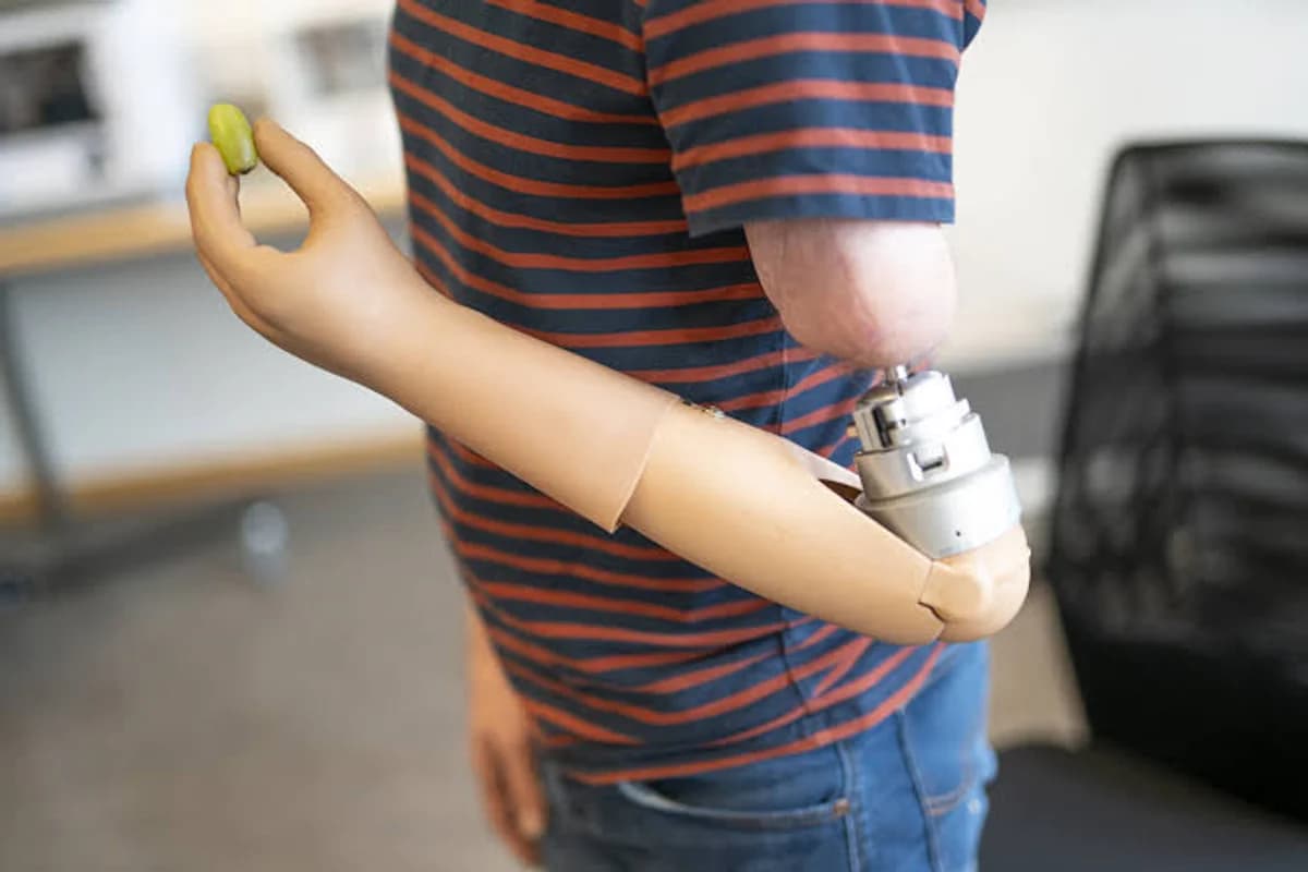 Prostheses Medical Billing Services