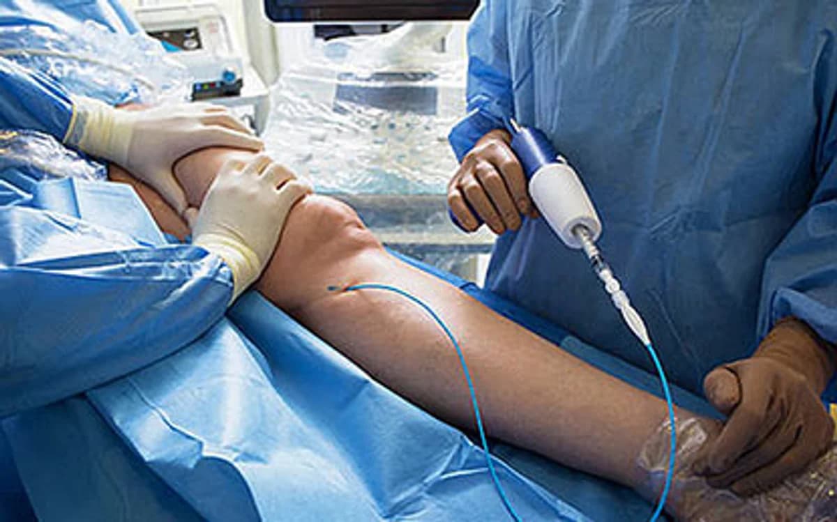 Vein Center Medical Billing Services